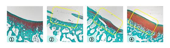 CGBio discovers a breakthrough in “cartilage” regeneration… Demonstrates the regenerative capabilities of “Hyaluronic Acid Gel” for cartilage