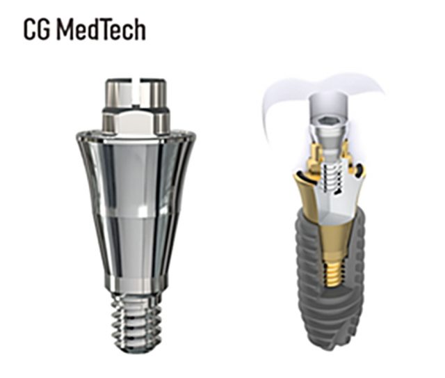 시지메드텍, 치과 임플란트 보철 신제품 ‘우루덴트 SA’ 출시